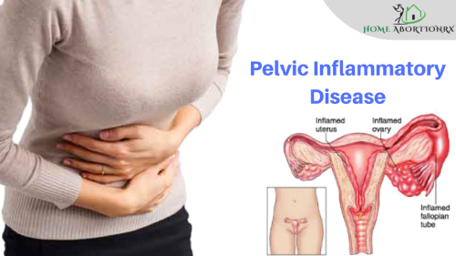 Information on Pelvic Inflammatory Disease