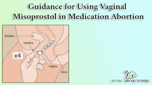 Guidance-For-Using-Vaginal-Misoprostol-In-Medication-Abortion